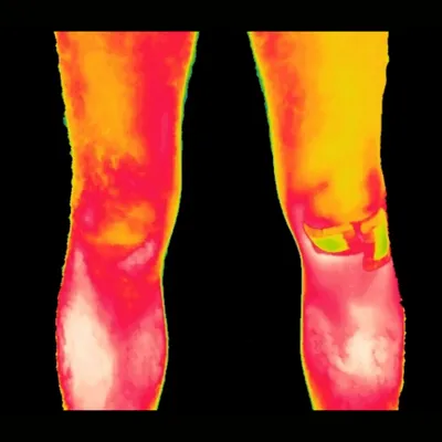 Baseline muscle analysis