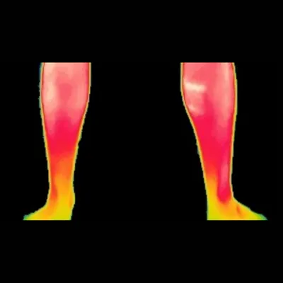 Recovered muscle analysis