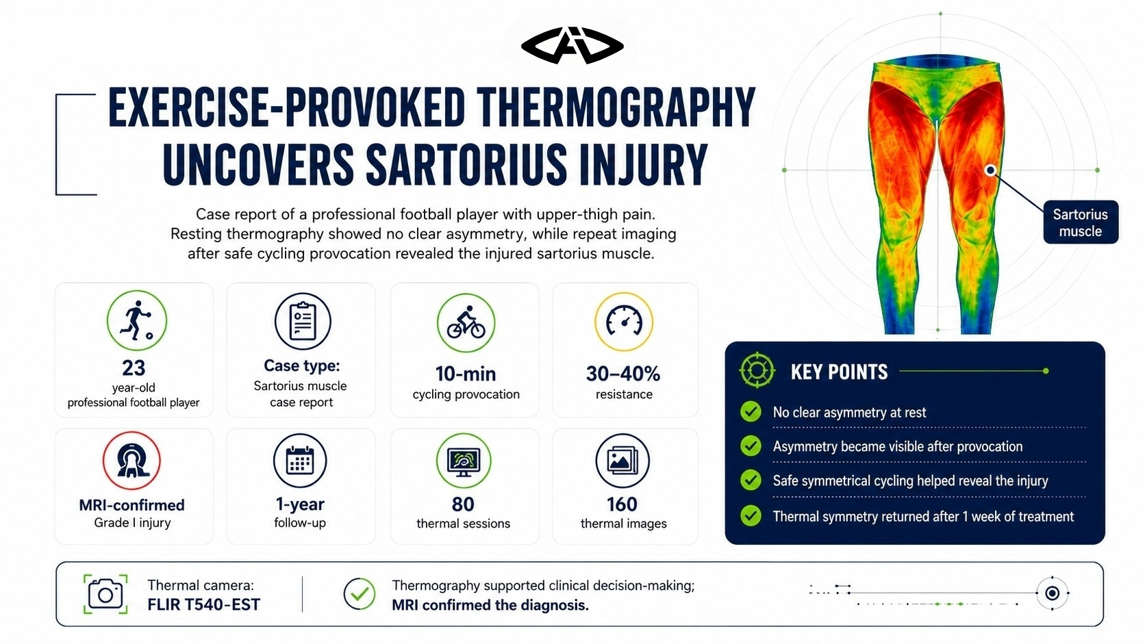 Egzersizle Ortaya Çıkan Sartorius Yaralanması